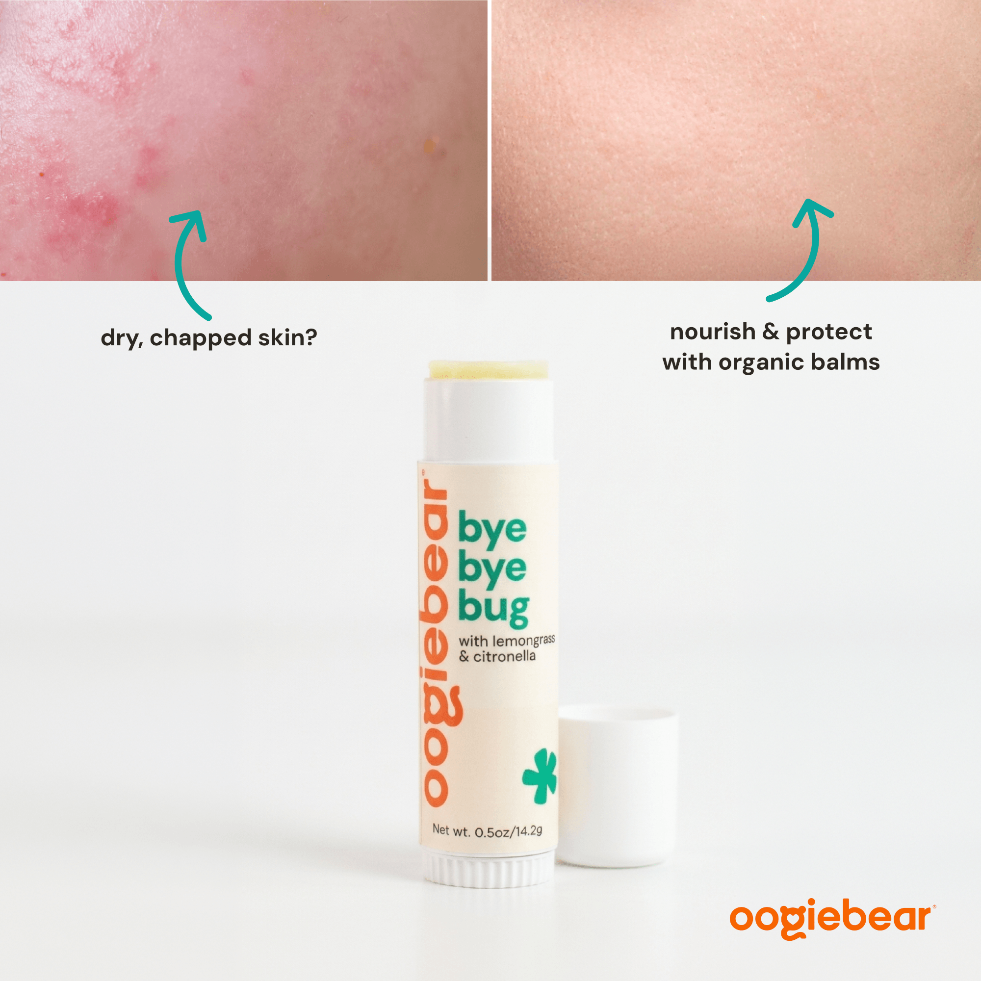 bug away balm